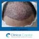 Slider image (9) Clinica Capilar